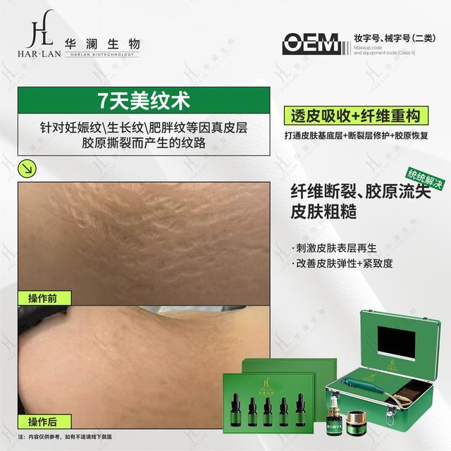 华澜生物7天美纹术击溃妊娠纹找回自信(图2)