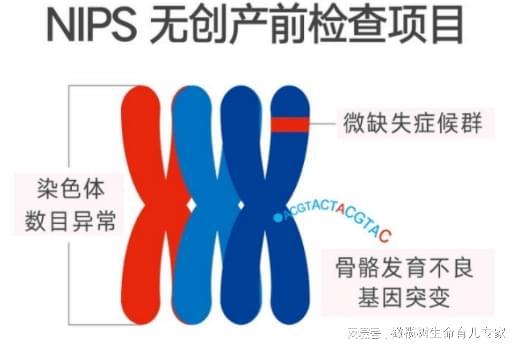 产检新选择：无创DNA和Plus版到底查了啥？(图3)