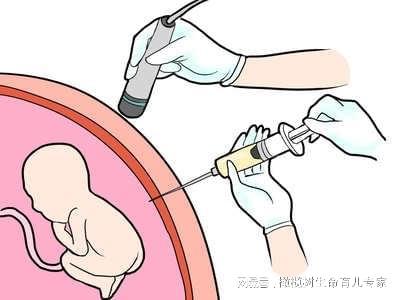 产检新选择：无创DNA和Plus版到底查了啥？(图6)