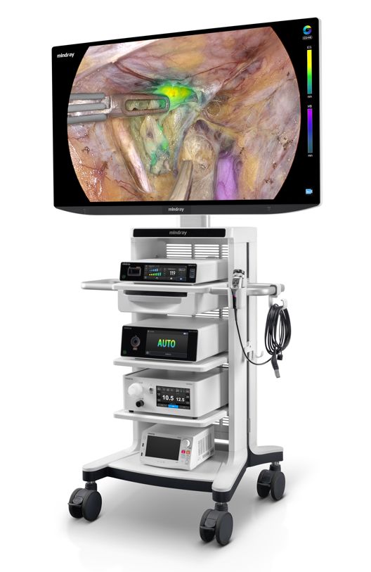 CMEF抢先看！联影、迈瑞、海尔生物、赛诺威盛、伟思医疗……(图2)