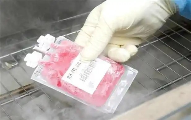 建设世界一流脐带血干细胞公共资源实体库：北京市脐带血库二十三年的光荣与梦想(图2)